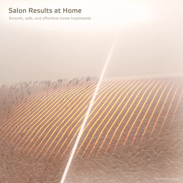 IPL Epilator inSPORTline Aphira